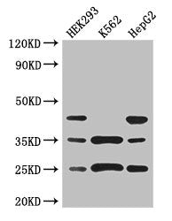 Western Blot | Positive WB detected in: HEK293 whole cell lysate, K562 whole cell lysate, HepG2 whole cell lysate | All lanes: PCTP antibody at 3μg/ml | Secondary | Goat polyclonal to rabbit IgG at 1/50000 dilution | Predicted band size: 25, 17 kDa | Observed band size: 25, 35, 45 kDaRabbit anti-Human PCTP Polyclonal Antibody