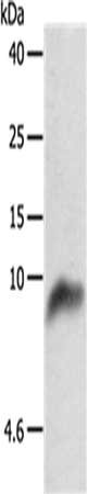 Gel: 10+15%SDS-PAGE, Lysate: 50 μg, Lane: 293T cells, Primary antibody: COX7B Antibody(COX7B Antibody) at dilution 1/800, Secondary antibody: Goat anti rabbit IgG at 1/8000 dilution, Exposure time: 40 secondsRabbit anti-Human COX7B Polyclonal Antibody