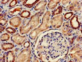 Immunohistochemistry of paraffin-embedded human kidney tissue using PDE2A Antibody at dilution of 1:100Rabbit anti-Human PDE2A Polyclonal Antibody