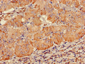 Immunohistochemistry of paraffin-embedded human adrenal gland tissue using PDE2A Antibody at dilution of 1:100Rabbit anti-Human PDE2A Polyclonal Antibody