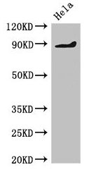 Western Blot  | Positive WB detected in: Hela whole cell lysate  | All lanes: PDE2A antibody at 2µg/ml  | Secondary  | Goat polyclonal to rabbit IgG at 1/50000 dilution  | Predicted band size: 106, 104, 105, 79, 88 kDa  | Observed band size: 88 kDaRabbit anti-Human PDE2A Polyclonal Antibody