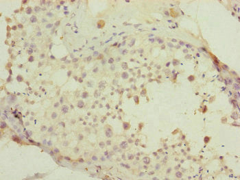 Immunohistochemistry of paraffin-embedded human testis tissue using PDHA2 Antibody at dilution of 1:100Rabbit anti-Human PDHA2 Polyclonal Antibody