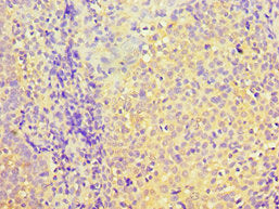 Immunohistochemistry of paraffin-embedded human tonsil tissue using PDHX Antibody at dilution of 1:100Rabbit anti-Human PDHX Polyclonal Antibody