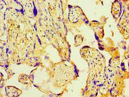 Immunohistochemistry of paraffin-embedded human placenta tissue using PDHX Antibody at dilution of 1:100Rabbit anti-Human PDHX Polyclonal Antibody