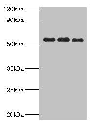 Western blot | All lanes: PDHX antibody at 6μg/ml | Lane 1: 293T whole cell lysate | Lane 2: PC-3 whole cell lysate | Lane 3: MCF-7 whole cell lysate | Secondary | Goat polyclonal to rabbit IgG at 1/10000 dilution | Predicted band size: 55, 30, 52 kDa | Observed band size: 55 kDaRabbit anti-Human PDHX Polyclonal Antibody