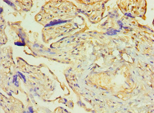 Immunohistochemistry of paraffin-embedded human placenta tissue using PDLIM1 Antibody at dilution of 1:100Rabbit anti-Human PDLIM1 Polyclonal Antibody