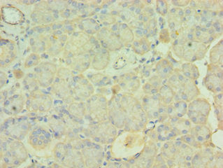 Immunohistochemistry of paraffin-embedded human pancreatic tissue using PDLIM1 Antibody at dilution of 1:100Rabbit anti-Human PDLIM1 Polyclonal Antibody