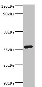 Western blot | All lanes: PDZ and LIM domain protein 1 antibody at 2μg/ml + HepG2 whole cell lysate | Secondary | Goat polyclonal to rabbit IgG at 1/10000 dilution | Predicted band size: 36 kDa | Observed band size: 36 kDaRabbit anti-Human PDLIM1 Polyclonal Antibody