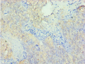Immunohistochemistry of paraffin-embedded human tonsil tissue using PDLIM1 Antibody at dilution of 1:100Rabbit anti-Human PDLIM1 Polyclonal Antibody
