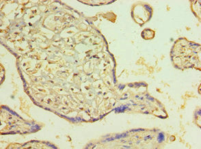 Immunohistochemistry of paraffin-embedded human placenta tissue using PDLIM1 Antibody at dilution of 1:100Rabbit anti-Human PDLIM1 Polyclonal Antibody