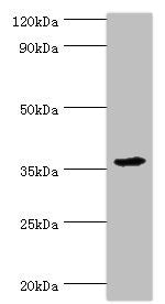 Western blot | All lanes: PDZ and LIM domain protein 1 antibody at 10μg/ml + Mouse lung tissue | Secondary | Goat polyclonal to rabbit IgG at 1/10000 dilution | Predicted band size: 36 kDa | Observed band size: 36 kDaRabbit anti-Human PDLIM1 Polyclonal Antibody