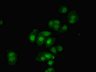 Immunofluorescent analysis of MCF-7 cells using PDPK1 Antibody at dilution of 1:100 and Alexa Fluor 488-congugated AffiniPure Goat Anti-Rabbit IgG(H+L)Rabbit anti-Human PDPK1 Polyclonal Antibody