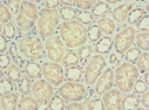 Immunohistochemistry of paraffin-embedded human kidney tissue using PDPK1 Antibody at dilution of 1:100Rabbit anti-Human PDPK1 Polyclonal Antibody