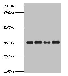 Western blot  | All lanes: PDXK antibody at 5.63µg/ml  | Lane 1: Mouse liver tissue  | Lane 2: Hela whole cell lysate  | Lane 3: Mouse kidney tissue  | Lane 4: HepG2 whole cell lysate  | Secondary  | Goat polyclonal to rabbit IgG at 1/10000 dilution  | Predicted band size: 36, 32, 27 kDa  | Observed band size: 36 kDaRabbit anti-Human PDXK Polyclonal Antibody