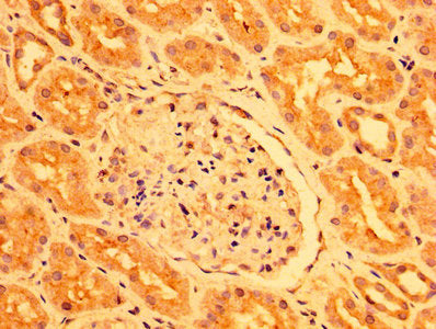 IHC image of PEAR1 Antibody diluted at 1:400 and staining in paraffin-embedded human kidney tissue performed on a Leica BondTM system. After dewaxing and hydration, antigen retrieval was mediated by high pressure in a citrate buffer (pH 6.0). Section was blocked with 10% normal goat serum 30min at RT. Then primary antibody (1% BSA) was incubated at 4°C overnight. The primary is detected by a biotinylated secondary antibody and visualized using an HRP conjugated SP system.Rabbit anti-Human PEAR1 Polyclonal Antibody