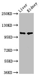Western Blot | Positive WB detected in: Rat liver tissue, Mouse kidney tissue | All lanes: PEAR1 antibody at 5.2μg/ml | Secondary | Goat polyclonal to rabbit IgG at 1/50000 dilution | Predicted band size: 111 kDa | Observed band size: 111 kDaRabbit anti-Human PEAR1 Polyclonal Antibody