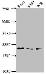 Western Blot  | Positive WB detected in: Hela whole cell lysate, A549 whole cell lysate, PC3 whole cell lysate  | All lanes: PEBP1 antibody at 1:2000  | Secondary  | Goat polyclonal to rabbit IgG at 1/50000 dilution  | Predicted band size: 22 kDa  | Observed band size: 22 kDaRabbit anti-Human PEBP1 Polyclonal Antibody