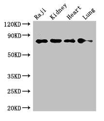 Western Blot | Positive WB detected in: Raji whole cell lysate, Mouse kidney tissue, Rat heart tissue, Rat lung tissue | All lanes: PECAM1 antibody at 2.7μg/ml | Secondary | Goat polyclonal to rabbit IgG at 1/50000 dilution | Predicted band size: 83, 81, 80, 82 kDa | Observed band size: 83 kDaRabbit anti-Human PECAM1 Polyclonal Antibody