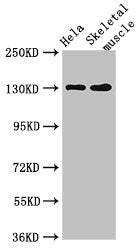 Western Blot  | Positive WB detected in: Hela whole cell lysate, Mouse skeletal muscle tissue  | All lanes: PER3 antibody at 4µg/ml  | Secondary  | Goat polyclonal to rabbit IgG at 1/50000 dilution  | Predicted band size: 132, 133 kDa  | Observed band size: 132 kDaRabbit anti-Human PER3 Polyclonal Antibody