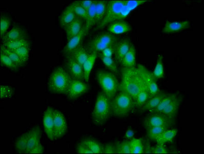 Immunofluorescence staining of HepG2 cells with GATB Antibody at 1:100, counter-stained with DAPI. The cells were fixed in 4% formaldehyde, permeabilized using 0.2% Triton X-100 and blocked in 10% normal Goat Serum. The cells were then incubated with the antibody overnight at 4°C. The secondary antibody was Alexa Fluor 488-congugated AffiniPure Goat Anti-Rabbit IgG(H+L).Rabbit anti-Human GATB Polyclonal Antibody