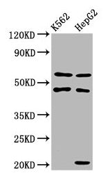 Western Blot  | Positive WB detected in: K562 whole cell lysate, HepG2 whole cell lysate  | All lanes: GATB antibody at 3.4µg/ml  | Secondary  | Goat polyclonal to rabbit IgG at 1/50000 dilution  | Predicted band size: 62 kDa  | Observed band size: 62 kDaRabbit anti-Human GATB Polyclonal Antibody