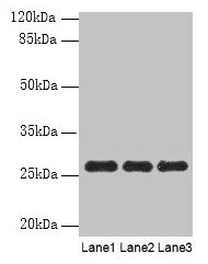 Western blot  | All lanes: PEX11B antibody at 10µg/ml  | Lane 1: 293T whole cell lysate  | Lane 2: Hela whole cell lysate  | Lane 3: K562 whole cell lysate  | Secondary  | Goat polyclonal to rabbit IgG at 1/10000 dilution  | Predicted band size: 29, 27 kDa  | Observed band size: 27 kDaRabbit anti-Human PEX11B Polyclonal Antibody