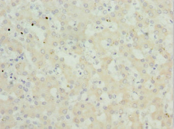 Immunohistochemistry of paraffin-embedded human liver tissue using PEX3 Antibody at dilution of 1:100Rabbit anti-Human PEX3 Polyclonal Antibody