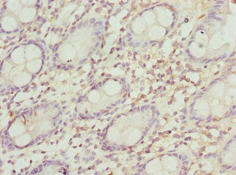Immunohistochemistry of paraffin-embedded human colon tissue using PEX3 Antibody at dilution of 1:100Rabbit anti-Human PEX3 Polyclonal Antibody