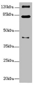Western blot | All lanes: PEX3 antibody at 1.11μg/ml + Mouse kidney tissue | Secondary | Goat polyclonal to rabbit IgG at 1/10000 dilution | Predicted band size: 42 kDa | Observed band size: 42, 82, 125 kDaRabbit anti-Human PEX3 Polyclonal Antibody