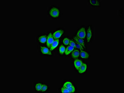 Immunofluorescent analysis of PC-3 cells using PFDN2 Antibody at dilution of 1:100 and Alexa Fluor 488-congugated AffiniPure Goat Anti-Rabbit IgG(H+L)Rabbit anti-Human PFDN2 Polyclonal Antibody