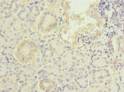 Immunohistochemistry of paraffin-embedded human pancreatic tissue using PFDN2 Antibody at dilution of 1:100Rabbit anti-Human PFDN2 Polyclonal Antibody