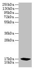Western blot  | All lanes: PFDN2 antibody at 6µg/ml + 293T whole cell lysate  | Secondary  | Goat polyclonal to rabbit IgG at 1/10000 dilution  | Predicted band size: 17 kDa  | Observed band size: 17 kDaRabbit anti-Human PFDN2 Polyclonal Antibody