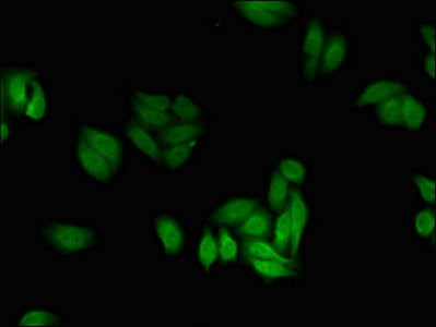 Immunofluorescent analysis of HepG2 cells using PFKFB2 Antibody at dilution of 1:100 and Alexa Fluor 488-congugated AffiniPure Goat Anti-Rabbit IgG(H+L)Rabbit anti-Human PFKFB2 Polyclonal Antibody