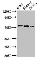 Western Blot  | Positive WB detected in: K562 whole cell lysate, Rat kidney tissue, Rat brain tissue  | All lanes: PFKFB2 antibody at 3µg/ml  | Secondary  | Goat polyclonal to rabbit IgG at 1/50000 dilution  | Predicted band size: 59, 55 kDa  | Observed band size: 55 kDaRabbit anti-Human PFKFB2 Polyclonal Antibody