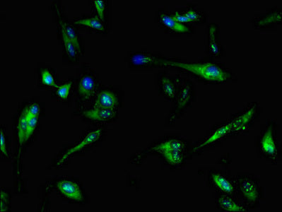 Immunofluorescent analysis of Hela cells using PFKL Antibody at dilution of 1:100 and Alexa Fluor 488-congugated AffiniPure Goat Anti-Rabbit IgG(H+L)Rabbit anti-Human PFKL Polyclonal Antibody