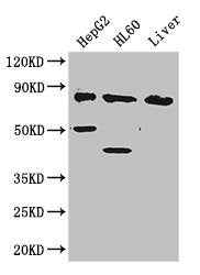 Western Blot | Positive WB detected in: HepG2 whole cell lysate, HL60 whole cell lysate, Mouse liver tissue | All lanes: PFKL antibody at 2.8μg/ml | Secondary | Goat polyclonal to rabbit IgG at 1/50000 dilution | Predicted band size: 86, 91 kDa | Observed band size: 86, 50, 40 kDaRabbit anti-Human PFKL Polyclonal Antibody