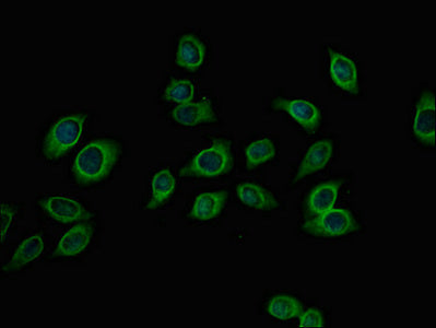 Immunofluorescent analysis of A549 cells using PFKM Antibody at dilution of 1:100 and Alexa Fluor 488-congugated AffiniPure Goat Anti-Rabbit IgG(H+L)Rabbit anti-Human PFKM Polyclonal Antibody