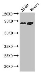 Western Blot  | Positive WB detected in: A549 whole cell lysate, Mouse heart tissue  | All lanes: PFKM antibody at 3.4µg/ml  | Secondary  | Goat polyclonal to rabbit IgG at 1/50000 dilution  | Predicted band size: 86, 82, 94 kDa  | Observed band size: 86 kDaRabbit anti-Human PFKM Polyclonal Antibody