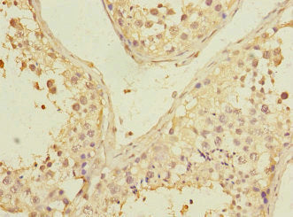 Immunohistochemistry of paraffin-embedded human testis tissue using PGAM2 Antibody at dilution of 1:100Rabbit anti-Human PGAM2 Polyclonal Antibody