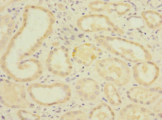 Immunohistochemistry of paraffin-embedded human kidney tissue using PGAM2 Antibody at dilution of 1:100Rabbit anti-Human PGAM2 Polyclonal Antibody
