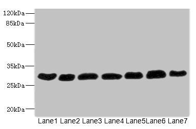 Western blot  | All lanes: PGAM2 antibody at 7.28µg/ml  | Lane 1: Rat heart tissue  | Lane 2: Mouse skeletal muscle tissue  | Lane 3: Hela whole cell lysate  | Lane 4: HepG2 whole cell lysate  | Lane 5: Jurkat whole cell lysate  | Lane 6: MCF-7 whole cell lysate  | Lane 7: U87 whole cell lysate  | Secondary  | Goat polyclonal to rabbit IgG at 1/10000 dilution  | Predicted band size: 29 kDa  | Observed band size: 29 kDaRabbit anti-Human PGAM2 Polyclonal Antibody
