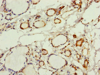 Immunohistochemistry of paraffin-embedded human thyroid tissue using PGLS Antibody at dilution of 1:100Rabbit anti-Human PGLS Polyclonal Antibody