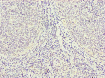 Immunohistochemistry of paraffin-embedded human tonsil tissue using PGLS Antibody at dilution of 1:100Rabbit anti-Human PGLS Polyclonal Antibody