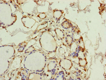 Immunohistochemistry of paraffin-embedded human thyroid tissue using PGLS Antibody at dilution of 1:100Rabbit anti-Human PGLS Polyclonal Antibody