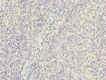 Immunohistochemistry of paraffin-embedded human tonsil tissue using PGLS Antibody at dilution of 1:100Rabbit anti-Human PGLS Polyclonal Antibody