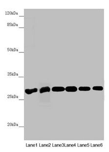Western blot  | All lanes: PGLS antibody at 3.94µg/ml  | Lane 1: Mouse liver tissue  | Lane 2: Mouse brain tissue  | Lane 3: U251 whole cell lysate  | Lane 4: THP-1 whole cell lysate  | Lane 5: HepG2 whole cell lysate  | Lane 6: Hela whole cell lysate  | Secondary  | Goat polyclonal to rabbit IgG at 1/10000 dilution  | Predicted band size: 28 kDa  | Observed band size: 28 kDaRabbit anti-Human PGLS Polyclonal Antibody