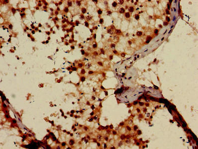 Immunohistochemistry of paraffin-embedded human testis tissue using PGM1 Antibody at dilution of 1:100Rabbit anti-Human PGM1 Polyclonal Antibody