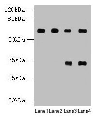 Western blot  | All lanes: PGM1 antibody at 6µg/ml  | Lane 1: U251 whole cell lysate  | Lane 2: U937 whole cell lysate  | Lane 3: Jurkat whole cell lysate  | Lane 4: Hela whole cell lysate  | Secondary  | Goat polyclonal to rabbit IgG at 1/10000 dilution  | Predicted band size: 62, 64, 41 kDa  | Observed band size: 62 kDaRabbit anti-Human PGM1 Polyclonal Antibody
