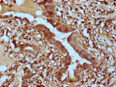 IHC image of PHACTR1 Antibody diluted at 1:400 and staining in paraffin-embedded human lung tissue performed on a Leica BondTM system. After dewaxing and hydration, antigen retrieval was mediated by high pressure in a citrate buffer (pH 6.0). Section was blocked with 10% normal goat serum 30min at RT. Then primary antibody (1% BSA) was incubated at 4°C overnight. The primary is detected by a biotinylated secondary antibody and visualized using an HRP conjugated SP system.Rabbit anti-Human PHACTR1 Polyclonal Antibody