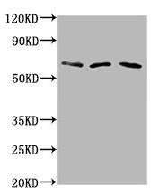 Western Blot  | Positive WB detected in: Hela whole cell lysate, Rat brain tissue, Mouse brain tissue  | All lanes: PHACTR1 antibody at 6µg/ml  | Secondary  | Goat polyclonal to rabbit IgG at 1/50000 dilution  | Predicted band size: 67, 55 kDa  | Observed band size: 67 kDaRabbit anti-Human PHACTR1 Polyclonal Antibody